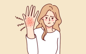 Unhappy woman suffer from rash on hand